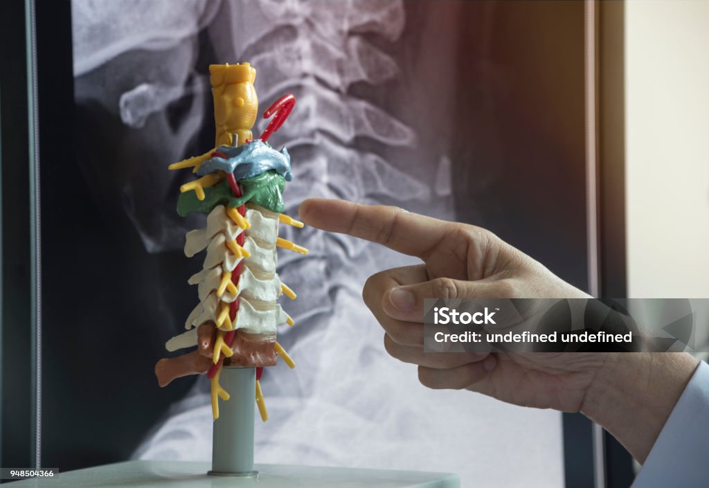 Doctor demonstrating cervical spine model Doctor pointing finger to demonstrate cervical spine model anatomy with x-ray of neck on computer monitor Neck Stock Photo