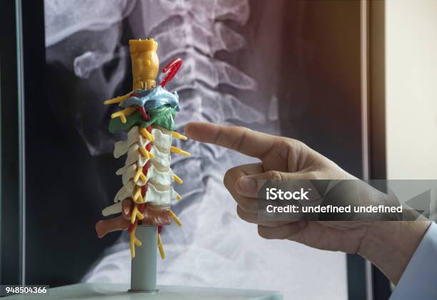 Doctor Demonstrating Cervical Spine Model Stock Photo - Download Image Now - Neck, Disk, Human Nervous System