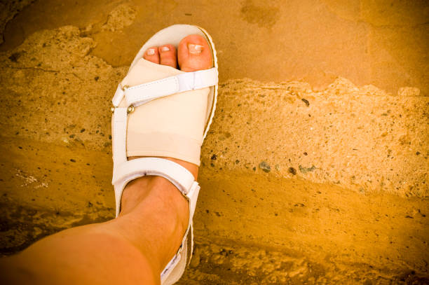 Broken toe in a white sandal in the desert of Morocco