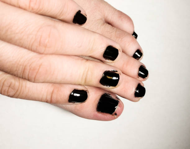 istock Black Manicure, Pedicure at home, missed the fingernails, mess. 948782368