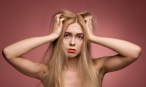 istock Confused woman who needs hair restoration 948905100