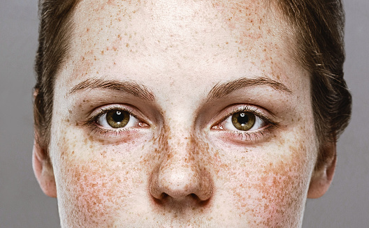Retrato de rostro ojos mujer joven pecas hermosa mujer con una piel sana photo