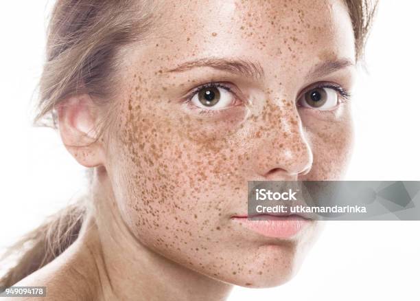 Junge Schöne Sommersprossen Frau Gesicht Portrait Mit Gesunder Haut Stockfoto und mehr Bilder von Sommersprosse
