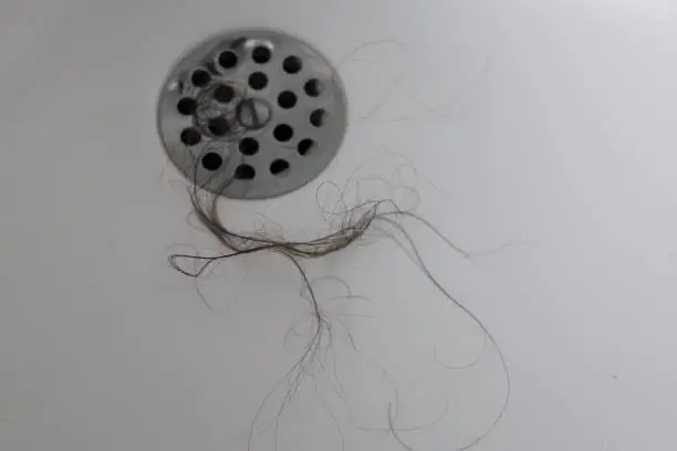 Photo of hair fallen into the sinks