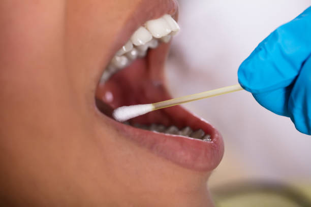 dentiste faisant le test de salive sur la bouche avec le coton-tige - human saliva photos et images de collection
