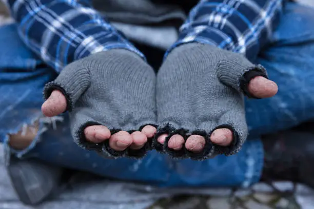Close-up Of A Beggar's Dirty Fingers Wearing Gloves