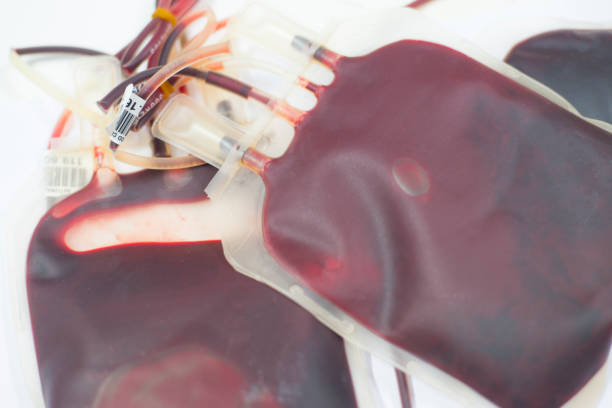 istock close up blood bag on with table in laboratory. 949258770