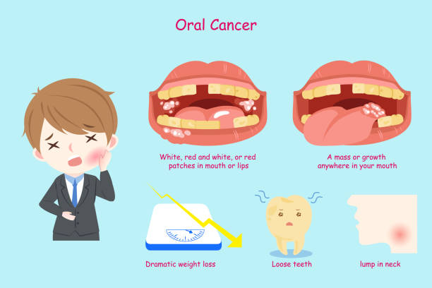 businessman with oral cancer businessman with oral cancer on the blue background oral  cancer stock illustrations