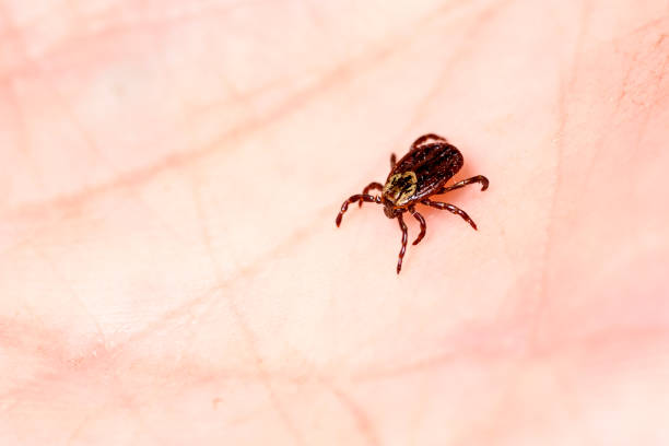 клещевой энцефалит на коже человека - lyme disease стоковые фото и изображения