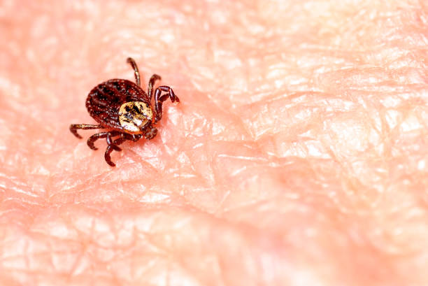 клещевой энцефалит на коже человека - lyme disease стоковые фото и изображения