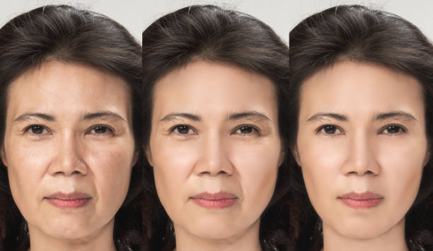 anti-aging-prozess, asiatische frau gesicht haut mit anti-aging-verfahren, verjüngung, lifting, straffung der gesichtshaut, wiederherstellung der jugendlichen haut anti-falten. alt und jung-konzept. - make over series stock-fotos und bilder