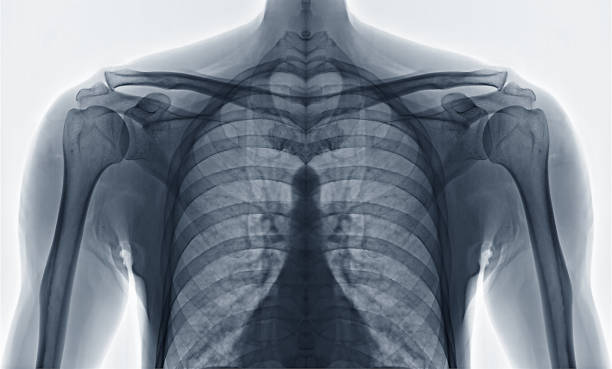parte delantera del hombro sobre fondo blanco para el tratamiento. - espalda partes del cuerpo fotos fotografías e imágenes de stock