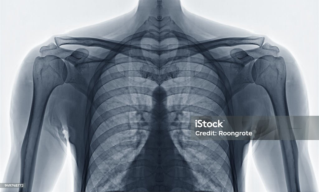 Shoulder front side on white background for treatment. Chest - Torso Stock Photo