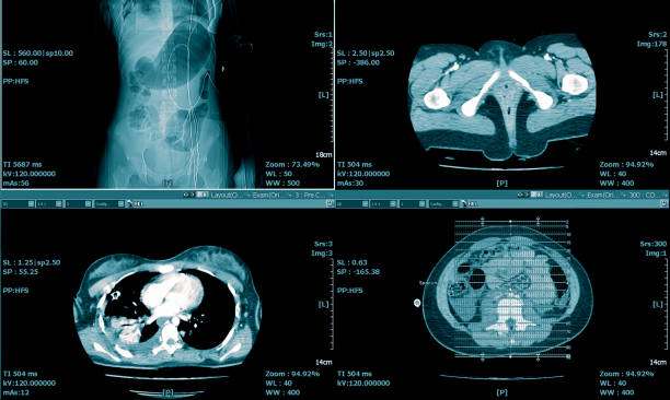 кт грудной клетки. медицинское обр�азование - healthcare and medicine human heart abdomen human spine стоковые фото и изображения