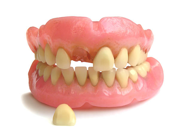 istock Pair of old ventures missing a tooth on white background 94992110