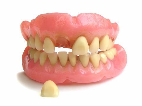 Image of a set of dentures, with one tooth that fell out. Photographed on a white background         