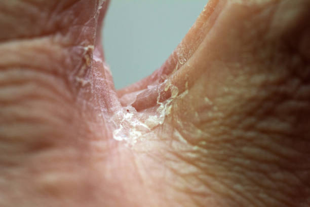 Close-up of a hand showing intricate skin texture and lines, symbolizing human touch and interaction, ideal for concepts related to health and personal communication.