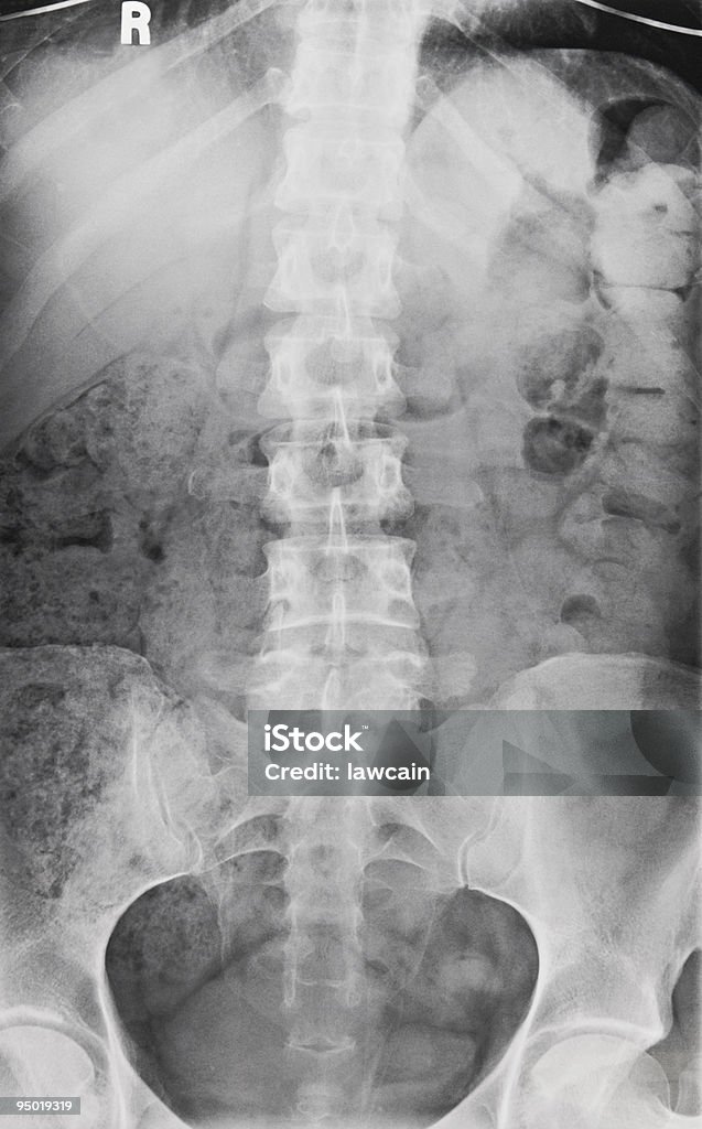 Raio-X da coluna vertebral e pélvica - Royalty-free Anatomia Foto de stock