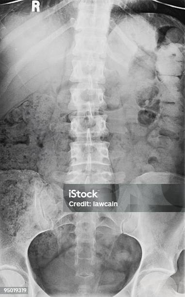 Raiox Da Coluna Vertebral E Pélvica - Fotografias de stock e mais imagens de Anatomia - Anatomia, Branco, Coluna vertebral humana