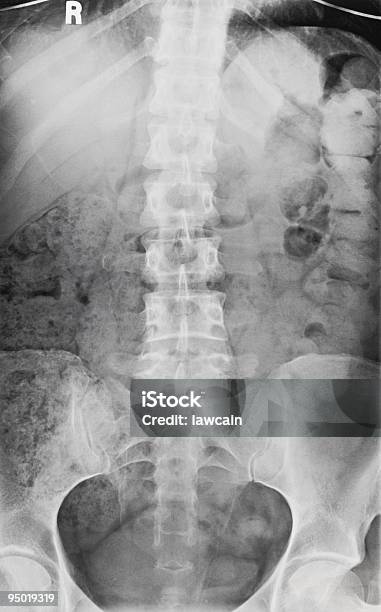 Позвоночник И Гинекологическое Обследование — стоковые фотографии и другие картинки Анатомия - Анатомия, Белый, Вертикальный