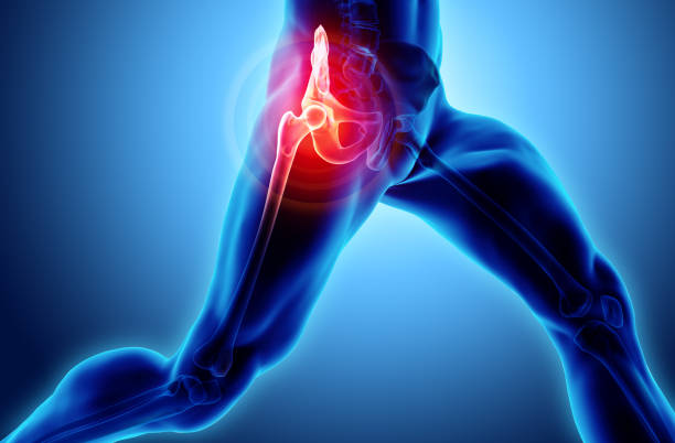 Hip painful skeleton x-ray, 3D illustration. 3D illustration, hip painful skeleton x-ray, medical concept. hip replacement stock pictures, royalty-free photos & images