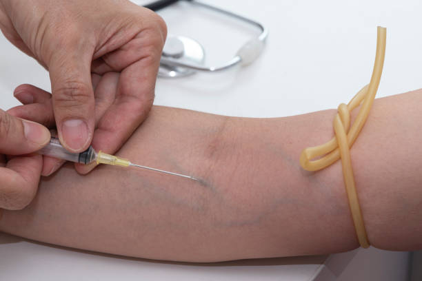 istock Preparing blood drawn from the vien 950725368
