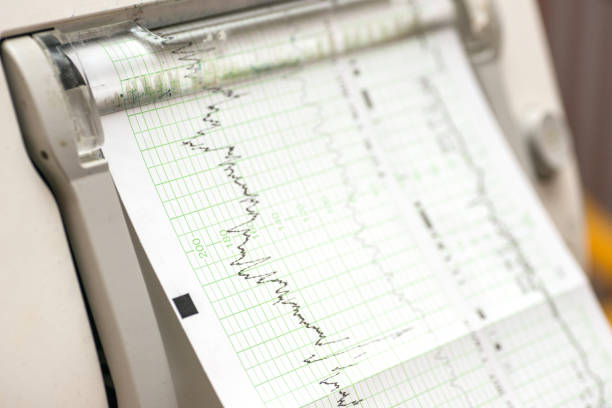 istock Wehenschreiber - Cardiotokograph 950861242
