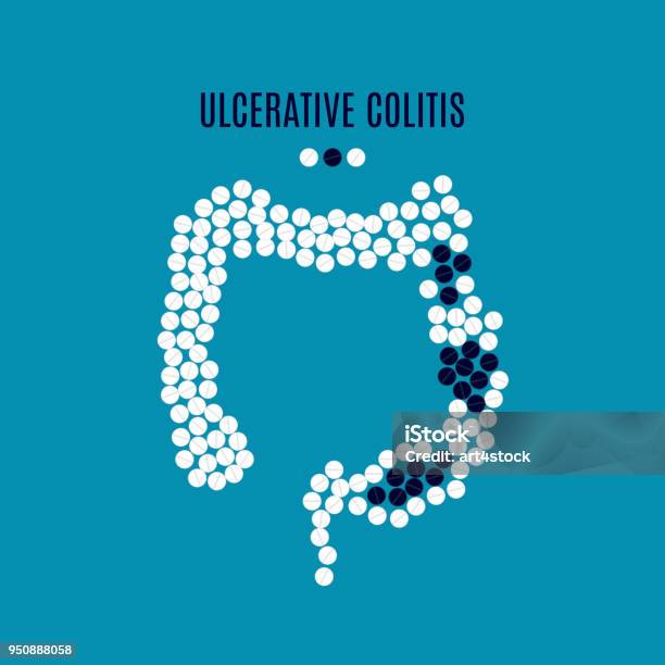 Colitis Tab Ulcerative Colitis Pills Poster Stock Illustration - Download Image Now ...