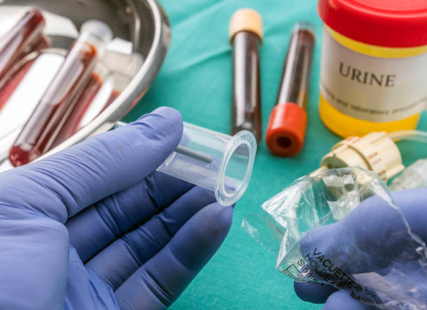 istock Doctor holds blood sample at a hospital table, conceptual image 951023760