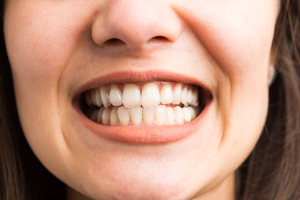 istock Young woman showing her teeth 951027500