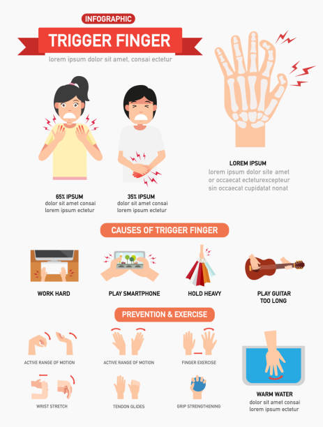 Trigger finger infographic Trigger finger infographic,vector illustration wrist exercise stock illustrations