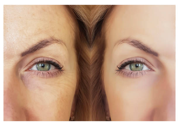 istock face woman wrinkles before and after 951137024
