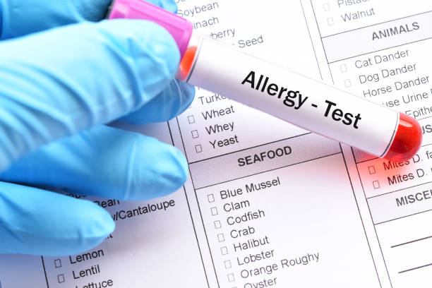 Food allergy test Test tube with blood sample for food allergy test allergy medicine stock pictures, royalty-free photos & images