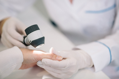 Closeup de dermatólogo examinar el lunar en la mano del paciente femenino en clínica photo
