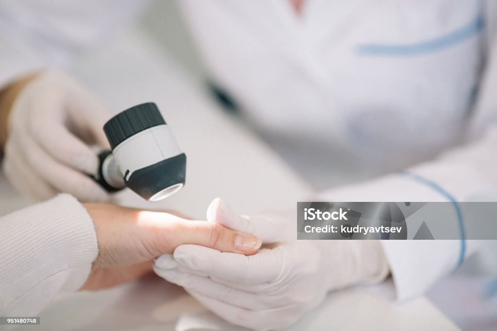 Closeup of dermatologist examining mole on hand of female patient in clinic Dermatology Stock Photo