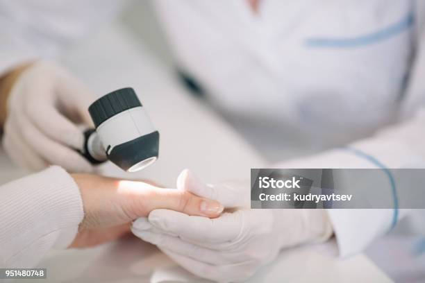 Closeup Of Dermatologist Examining Mole On Hand Of Female Patient In Clinic Stock Photo - Download Image Now