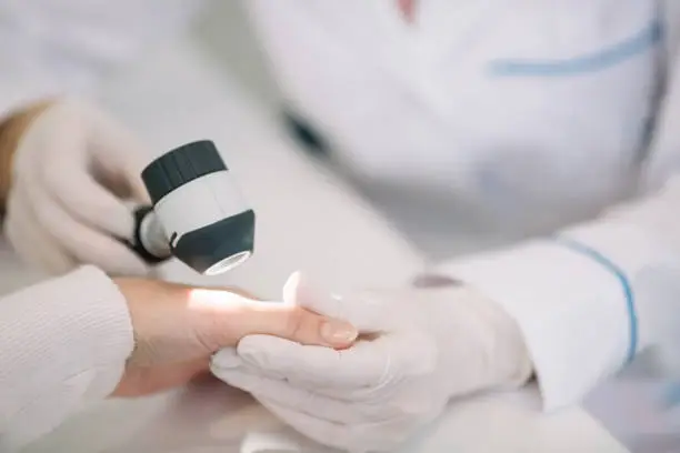 Photo of Closeup of dermatologist examining mole on hand of female patient in clinic