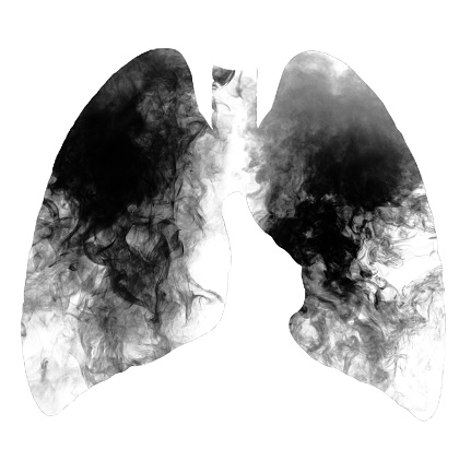 Computed tomography of chest organs. CT scan.