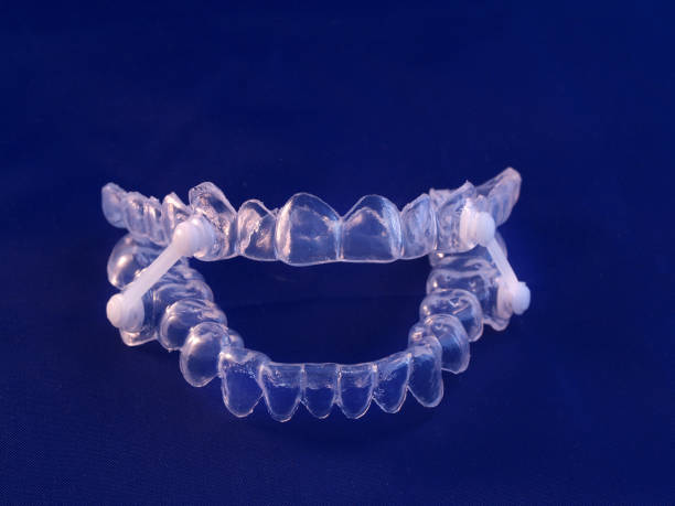 Appliance for control of movement jaws as prevention of sleep apnea Appliance for management of jaws during obstructive sleep apnea sleep apnea photos stock pictures, royalty-free photos & images