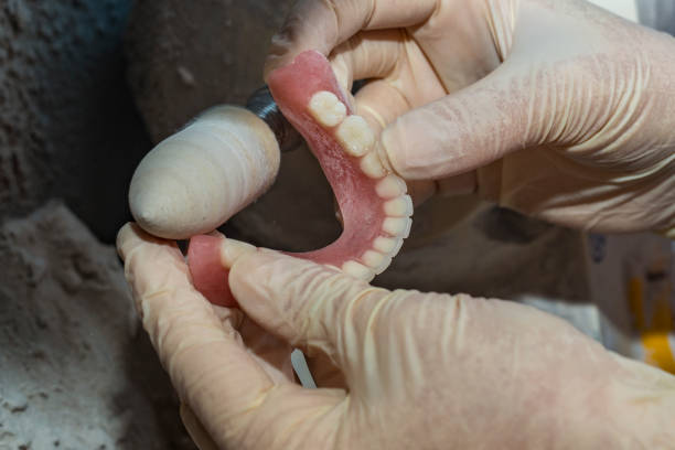 istock Dental technician working on dental prosthetic for to polish up 951715548