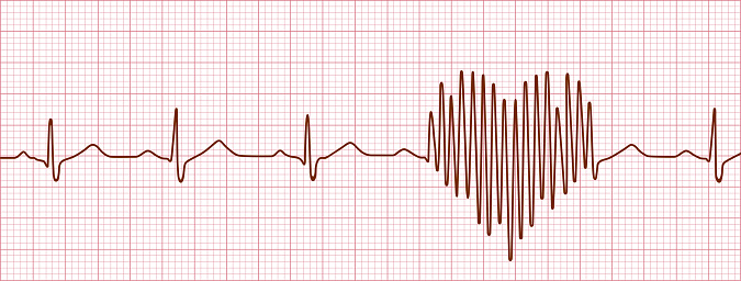 Cardiogram of declaration of love, vector