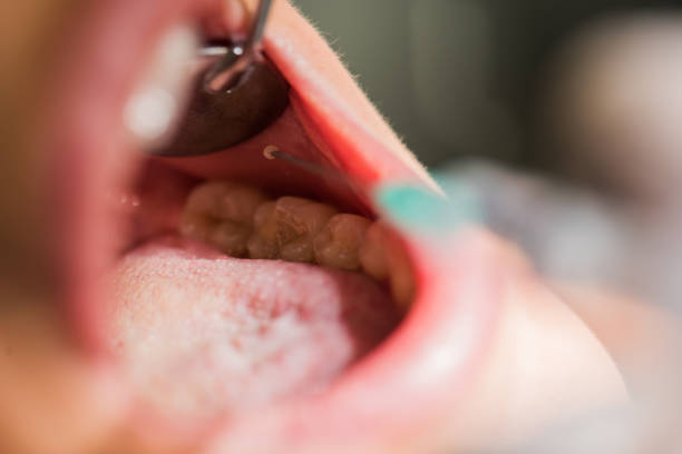 Close up of unrecognizable woman receiving anesthetic during dental procedure.