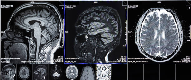 ct-scans des menschlichen kopfes - mri scanner stock-fotos und bilder