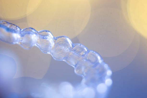 Teeth aligner invisible dentist retainer brackets to straighten teeth in cosmetic beauty dentistry dental treatment Teeth aligner invisible dentist retainer brackets to straighten teeth in cosmetic beauty dentistry dental treatment. chemical straightener stock pictures, royalty-free photos & images