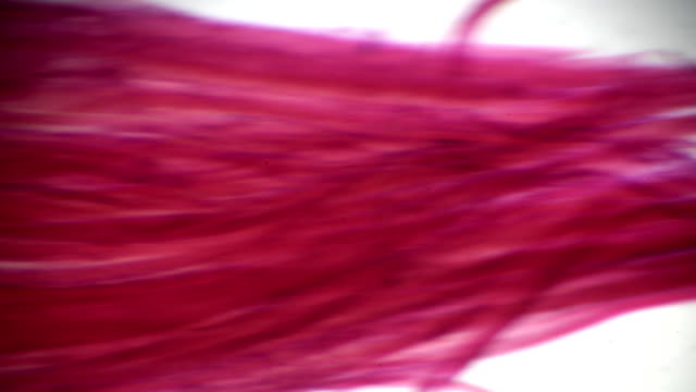 Trichinella under light microscopy