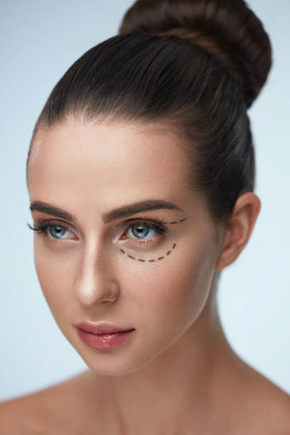 istock Plastic Surgery Operation. Woman Face With Black Surgical Lines 952839556