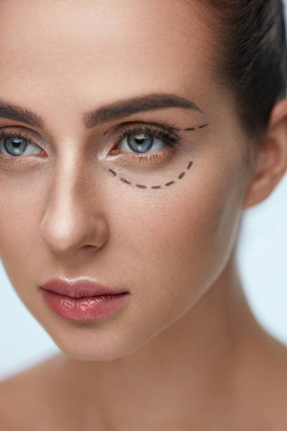 istock Plastic Surgery Operation. Woman Face With Black Surgical Lines 952840886