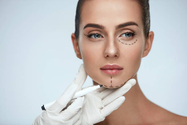 Treatment. Beautician Drawing Surgical Lines On Woman Face stock photo