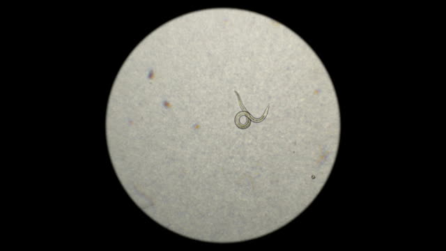 the nematode worm under a microscope
