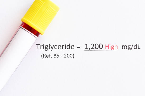 Triglycerides Lab Test 40+ Lab Report For Cholesterol Stock Photos, Pictures & Royalty-Free ...